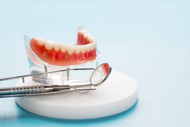 Dental Inlays and Onlays in North Hartsville, SC